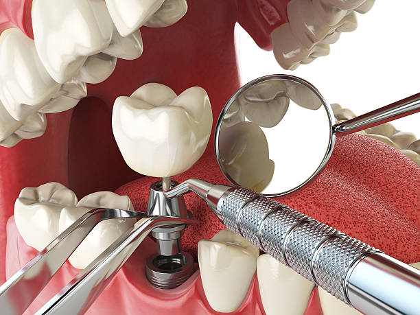 Best Pediatric Emergency Dentist in Quincy, MI